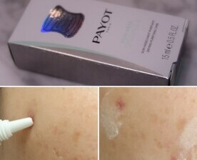트러블케어 이뻐지고 싶어서 사용중이에요!